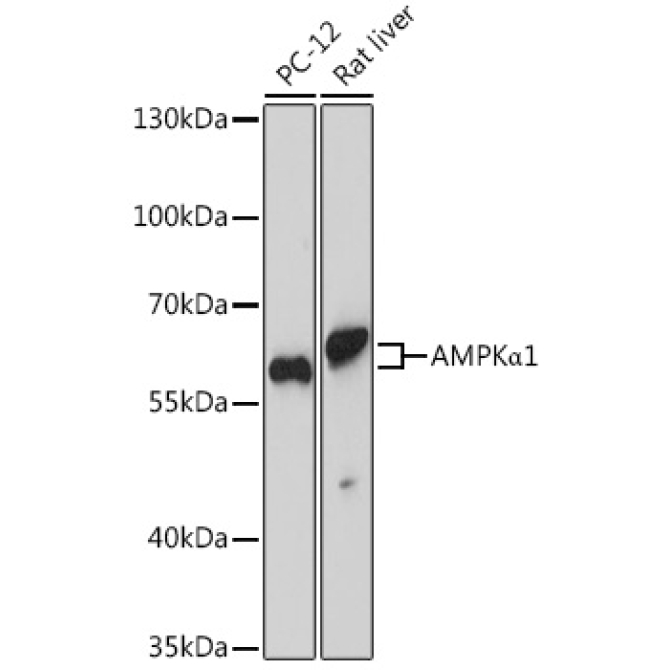 AMPKAlpha1 Rabbit Polyclonal Antibody