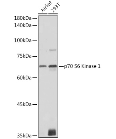 p70 S6 Kinase 1 Rabbit Polyclonal Antibody