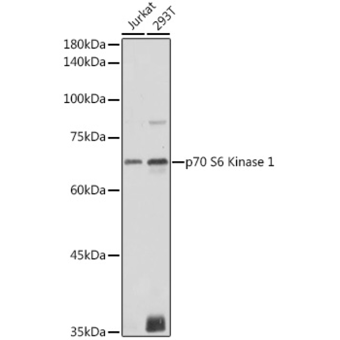 p70 S6 Kinase 1 Rabbit Polyclonal Antibody