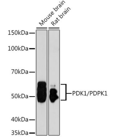 PDK1/PDPK1 Rabbit Polyclonal Antibody [KO Validated]