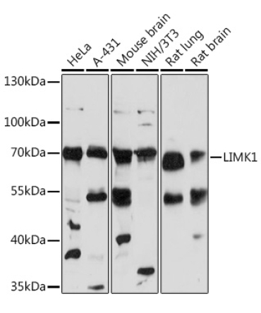 LIMK1 Rabbit Polyclonal Antibody