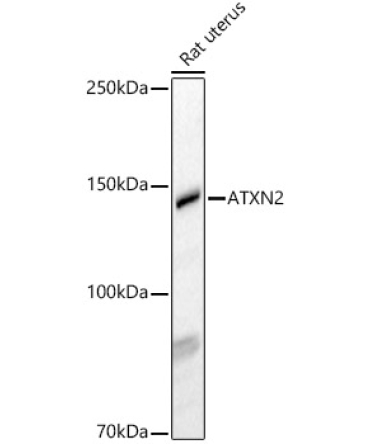 ATXN2 Rabbit Polyclonal Antibody