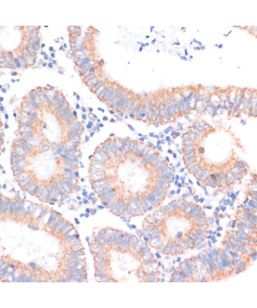 eIF4EBP1 Rabbit Polyclonal Antibody