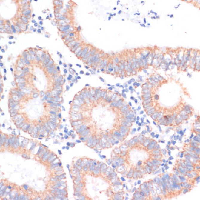 eIF4EBP1 Rabbit Polyclonal Antibody
