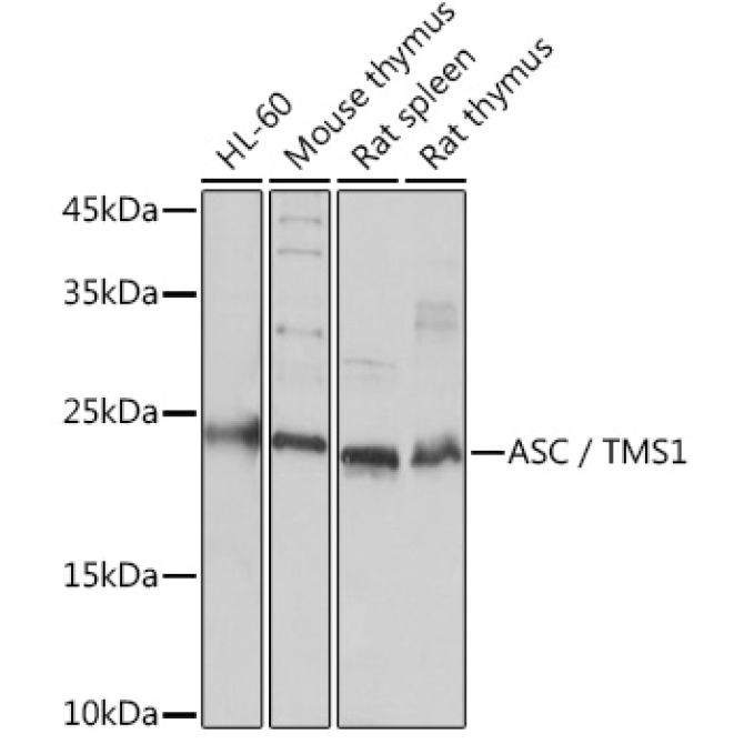 ASC/TMS1 Rabbit Polyclonal Antibody