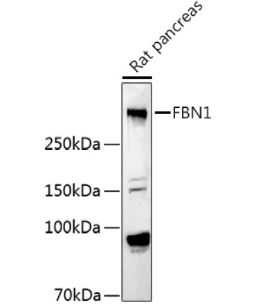 Fibrillin 1 Rabbit Polyclonal Antibody