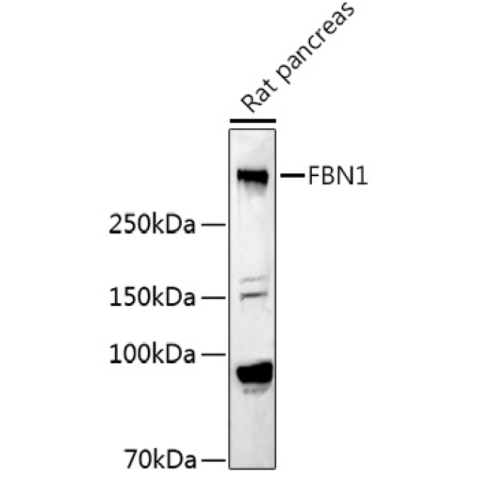 Fibrillin 1 Rabbit Polyclonal Antibody