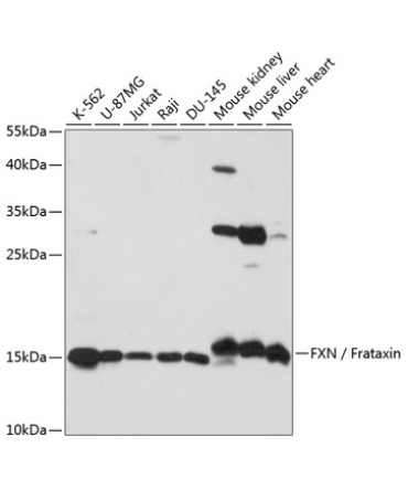 FXN / Frataxin Rabbit Polyclonal Antibody