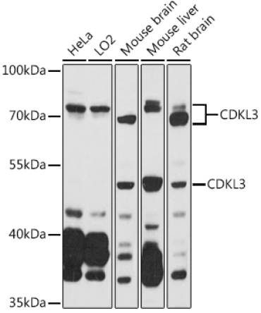 CDKL3 Rabbit Polyclonal Antibody