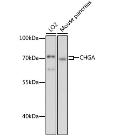 CHGA Rabbit Polyclonal Antibody