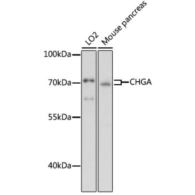 CHGA Rabbit Polyclonal Antibody