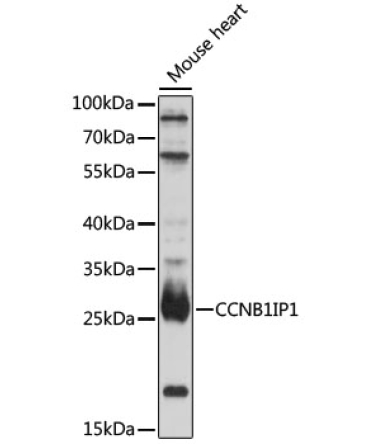 CCNB1IP1 Rabbit Polyclonal Antibody