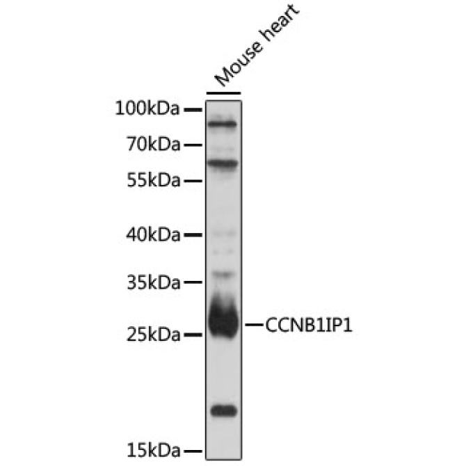 CCNB1IP1 Rabbit Polyclonal Antibody