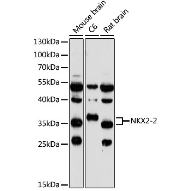 NKX2-2 Rabbit Polyclonal Antibody