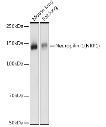 Neuropilin-1 (NRP1) Rabbit Polyclonal Antibody