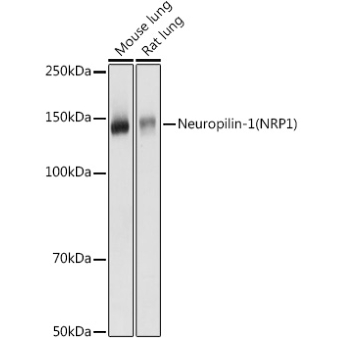 Neuropilin-1 (NRP1) Rabbit Polyclonal Antibody