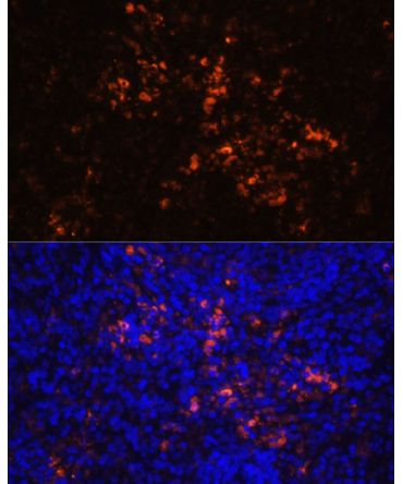 CD70 Rabbit Polyclonal Antibody
