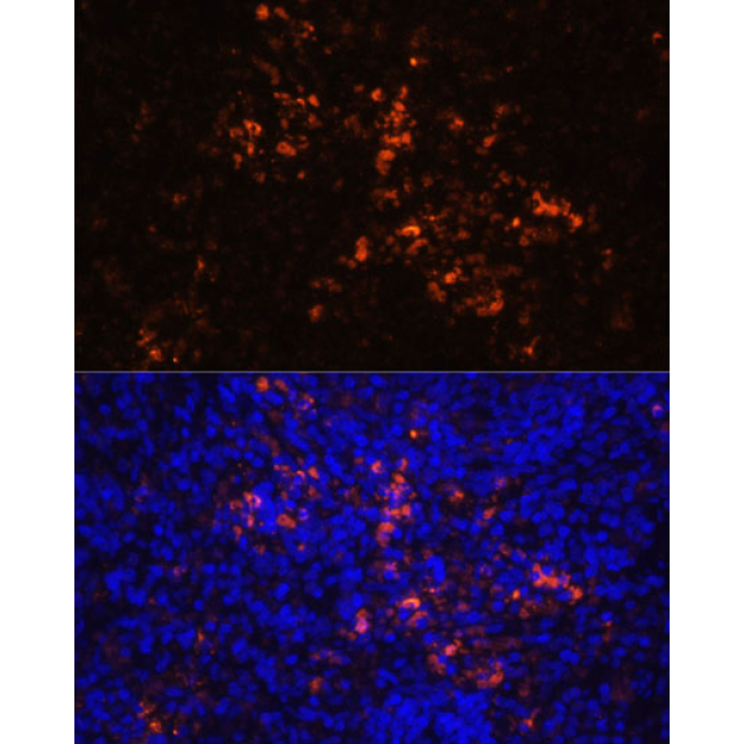 CD70 Rabbit Polyclonal Antibody