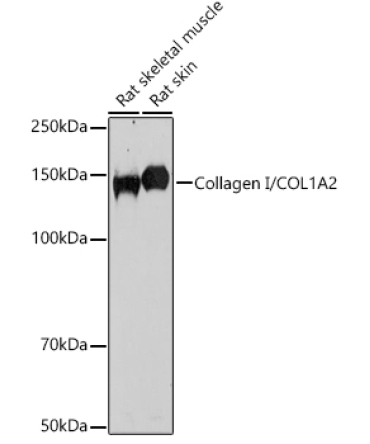 Collagen I/COL1A2 Rabbit Polyclonal Antibody