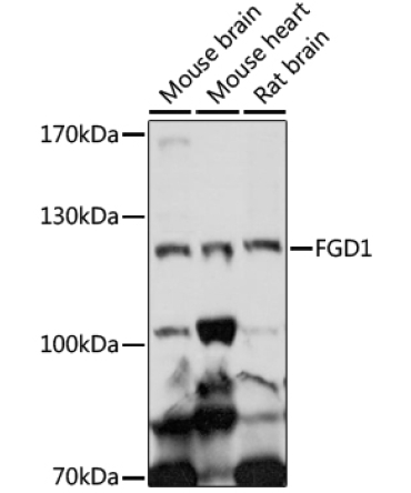 FGD1 Rabbit Polyclonal Antibody