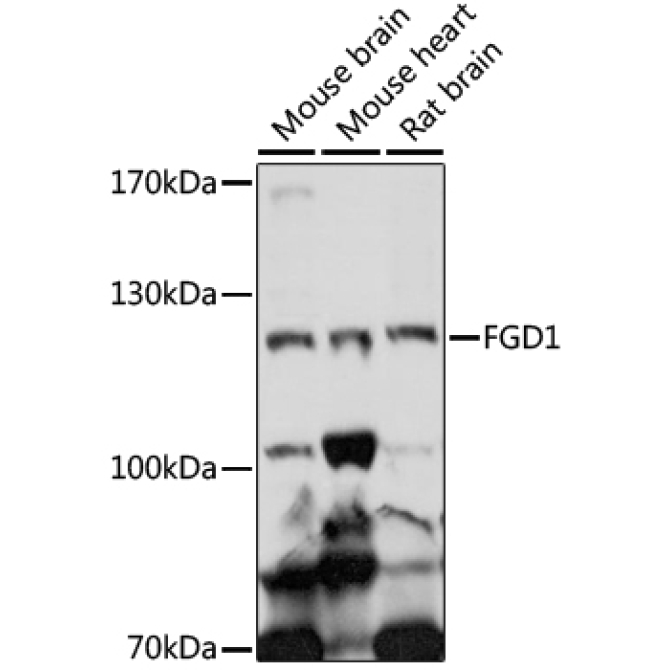 FGD1 Rabbit Polyclonal Antibody