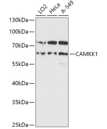 CAMKK1 Rabbit Polyclonal Antibody