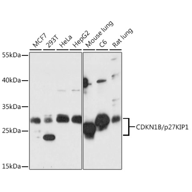 CDKN1B/p27KIP1 Rabbit Polyclonal Antibody