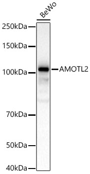 AMOTL2 Rabbit Polyclonal Antibody
