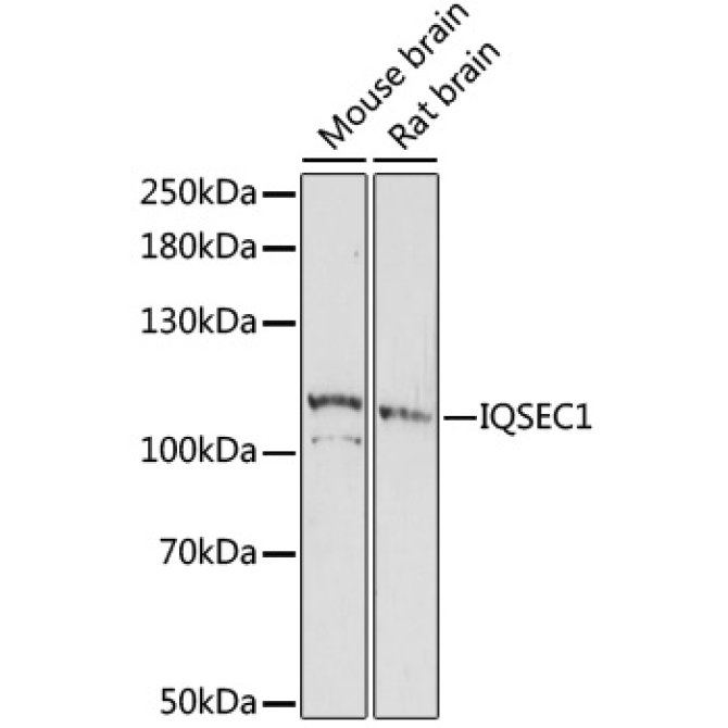 IQSEC1 Rabbit Polyclonal Antibody