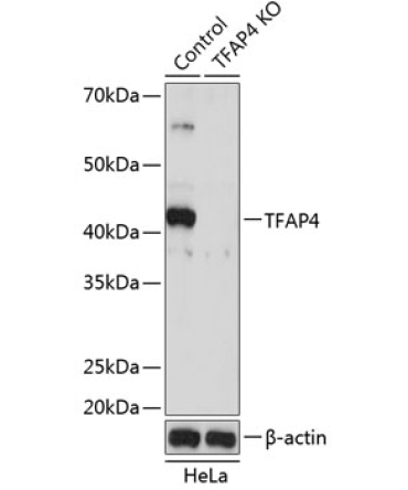 TFAP4 Rabbit Polyclonal Antibody [KO Validated]