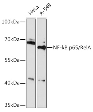 NF-kB p65/RelA Rabbit Polyclonal Antibody
