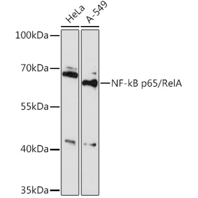 NF-kB p65/RelA Rabbit Polyclonal Antibody
