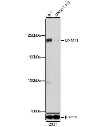 DNMT1 Rabbit Polyclonal Antibody [KD Validated]