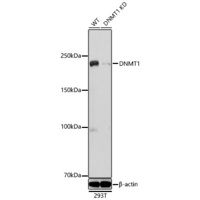 DNMT1 Rabbit Polyclonal Antibody [KD Validated]