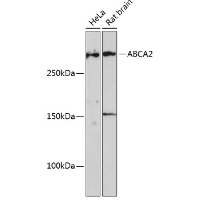 ABCA2 Rabbit Polyclonal Antibody