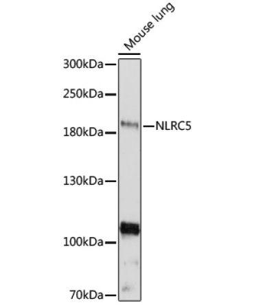 NLRC5 Rabbit Polyclonal Antibody