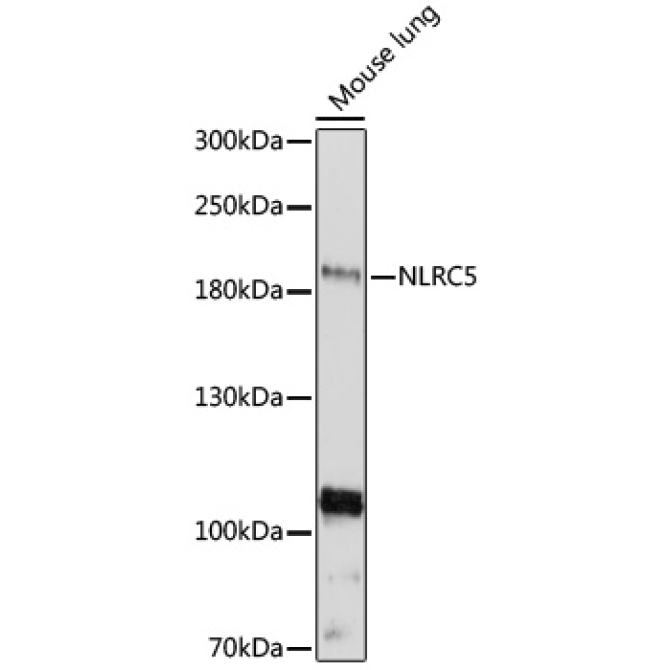 NLRC5 Rabbit Polyclonal Antibody