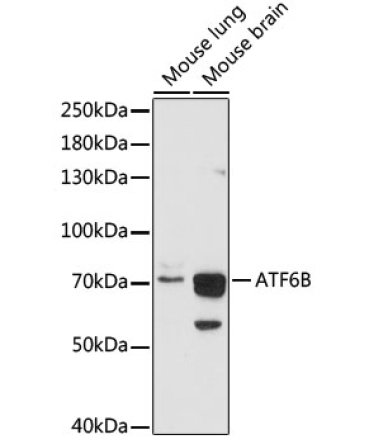 ATF6B Rabbit Polyclonal Antibody
