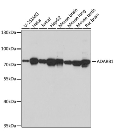 ADARB1 Rabbit Polyclonal Antibody