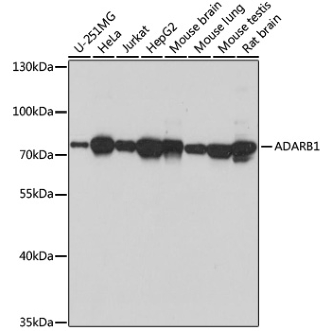 ADARB1 Rabbit Polyclonal Antibody