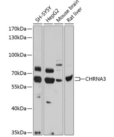 CHRNA3 Rabbit Polyclonal Antibody