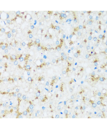 APOD Rabbit Polyclonal Antibody