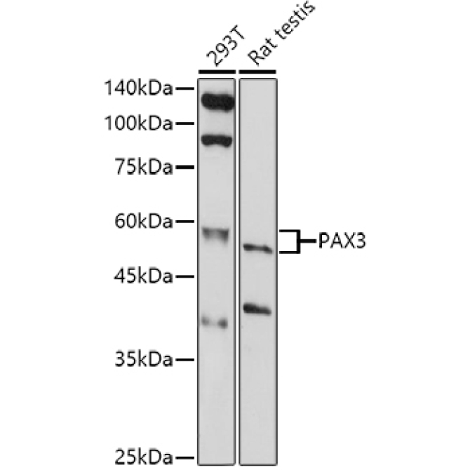 PAX3 Rabbit Polyclonal Antibody