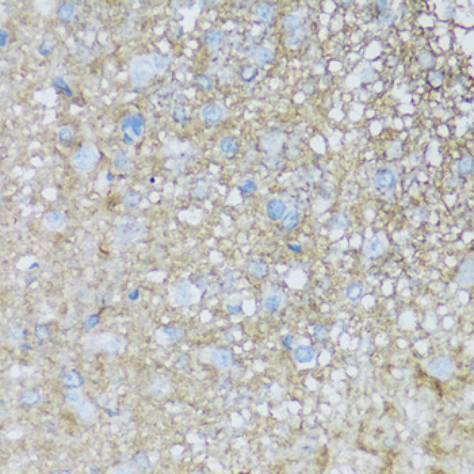 ATP1B2 Rabbit Polyclonal Antibody