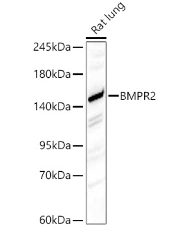 BMPR2 Rabbit Polyclonal Antibody