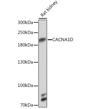 CACNA1D Rabbit Polyclonal Antibody