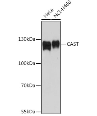 CAST Rabbit Polyclonal Antibody