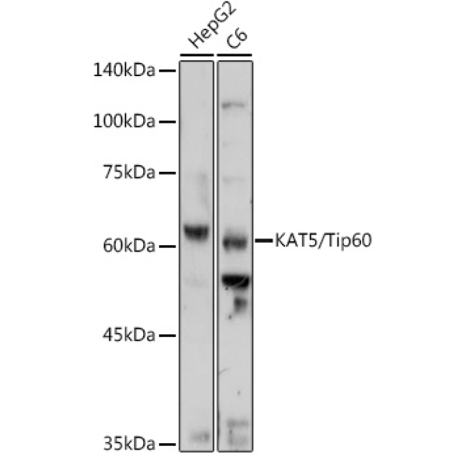 KAT5/Tip60 Rabbit Polyclonal Antibody