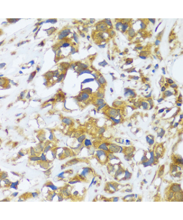 CAST Rabbit Polyclonal Antibody