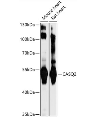 CASQ2 Rabbit Polyclonal Antibody